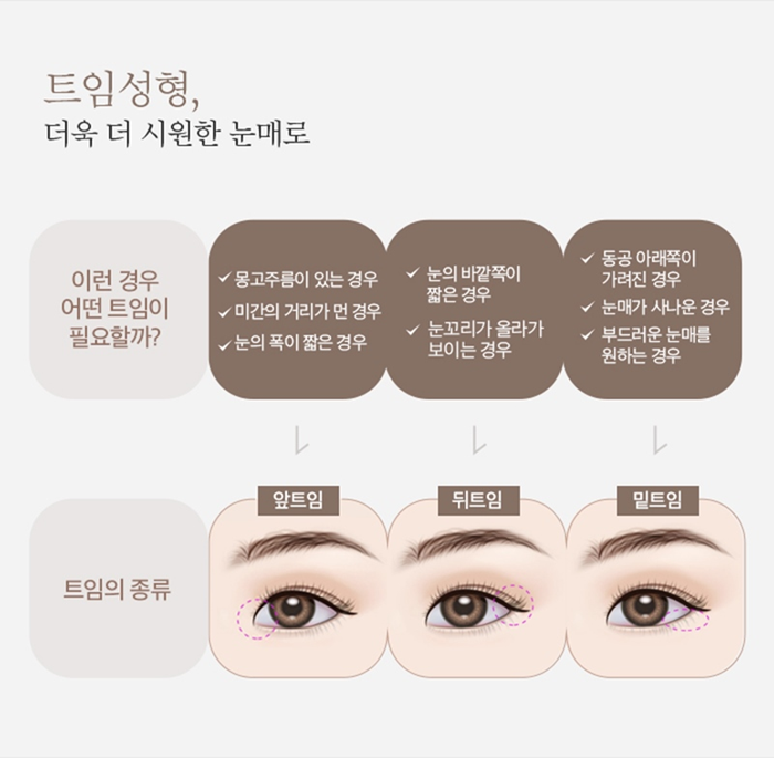 눈 뒤트임 앞트임 위트임 밑트임 에이트풀트임 관련 이미지 4