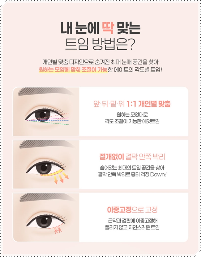 내 눈에 맞는 앞트임 필요할까? 수술 방법과 대략적인 비용 안내 관련 이미지 7