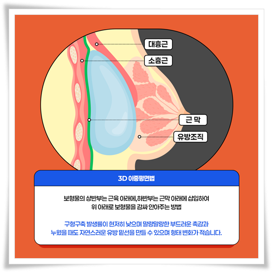 Famous Plastic Surgery Clinic in Gangnam: How Should You Care for Yourself After Breast Surgery? image 12