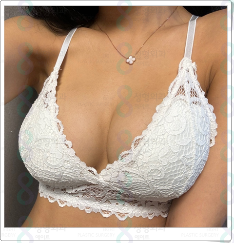 가슴확대수술비용 부작용 가능성을 낮추려면? 관련 이미지 6