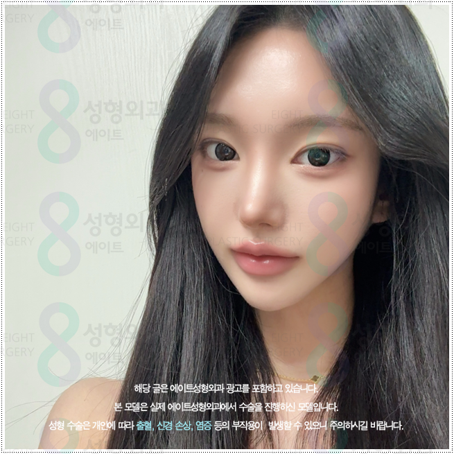What Types of Rhinoplasty Are Available in Apgujeong? A Look at Bridge and Tip Surgery Prices and Recovery Times image 3