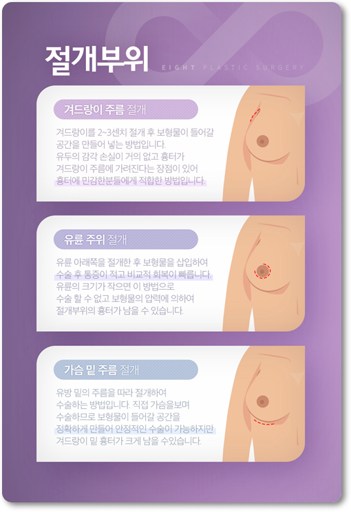 Breast Augmentation Surgery Review: Implants, Recovery Time, and How to Minimize Side Effects image 15