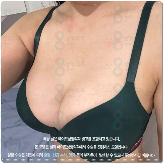 멘토 엑스트라 하이 타입? 스무스 차이, 부스트까지 비교해보면 비용은 어느 정도일까 관련 이미지 2