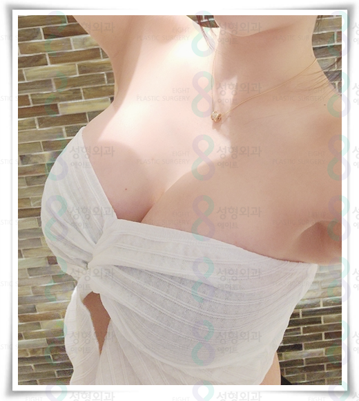 Best Places for Breast Augmentation: A Summary of Breast Implant Types, Pros, and Cons image 5