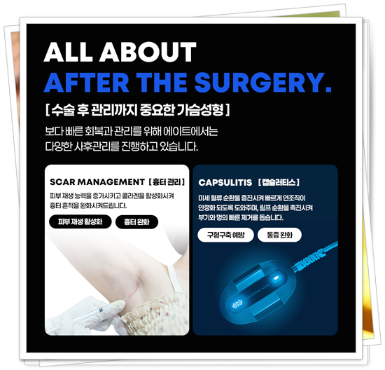 Breast Ptosis Surgery Price, How Are the Reviews? image 14