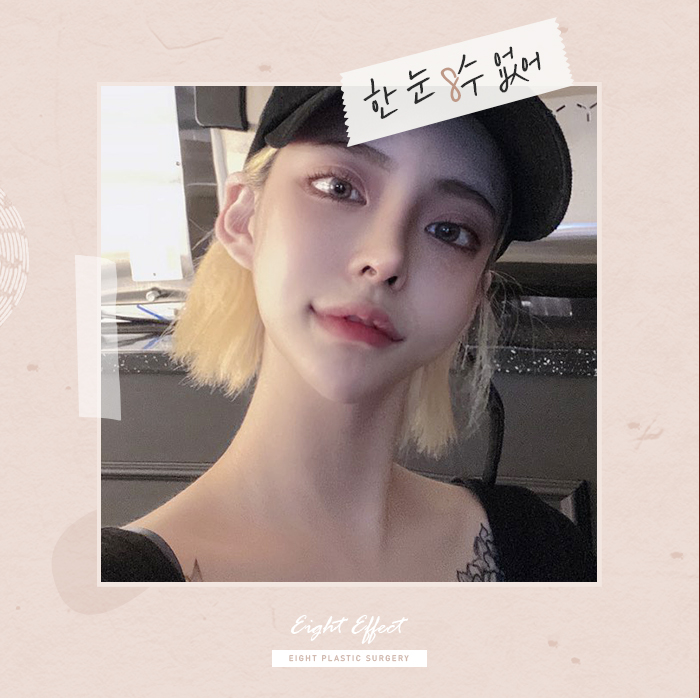 V라인사각턱 자갈턱 돌려깎기 관련 이미지 4
