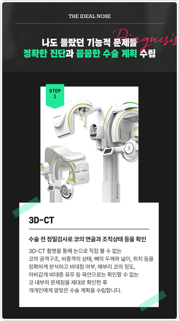복코성형 콧볼축소 1개월 차! 코성형 붓기 빨리 빼는법과 코끝수술 후기 찾으셨나요? 관련 이미지 12