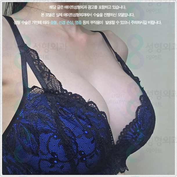 가슴 절벽 걱정? 가슴확대 수술 비용과 촉감, 후기 만족에 대해서 (멘토 스무스) 관련 이미지 3