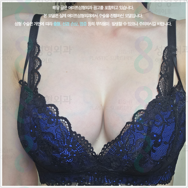 가슴 절벽 걱정? 가슴확대 수술 비용과 촉감, 후기 만족에 대해서 (멘토 스무스) 관련 이미지 1