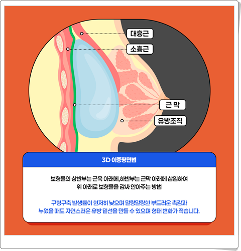 멘토 엑스트라 가격 후기가 궁금하실땐 관련 이미지 13
