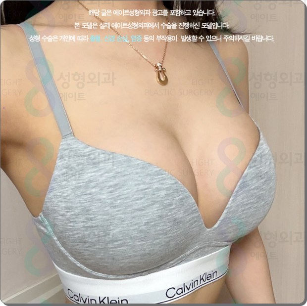 압구정역 가슴수술, 성형외과 추천? 멘토 엑스트라는 비용 전에 가슴 트레이닝센터, 의사를 확인 관련 이미지 4