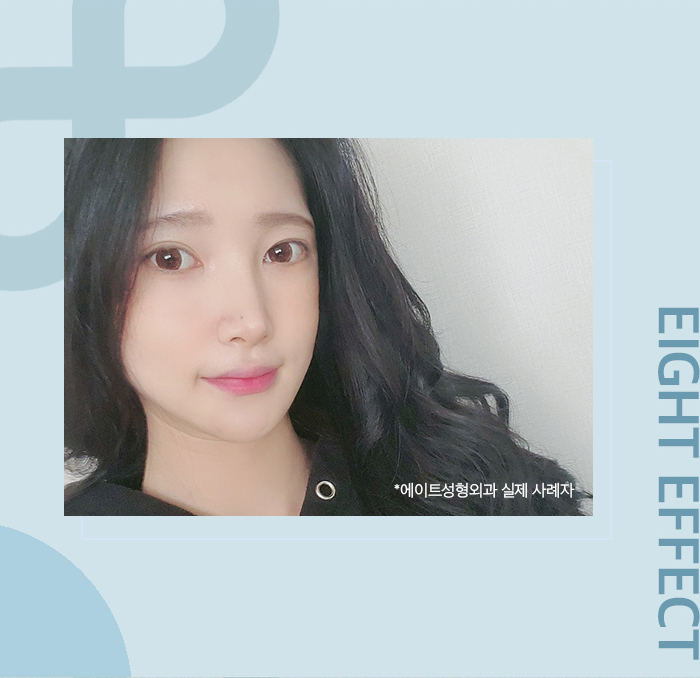 출산후가슴수술 자신감을 되찾는 관련 이미지 6