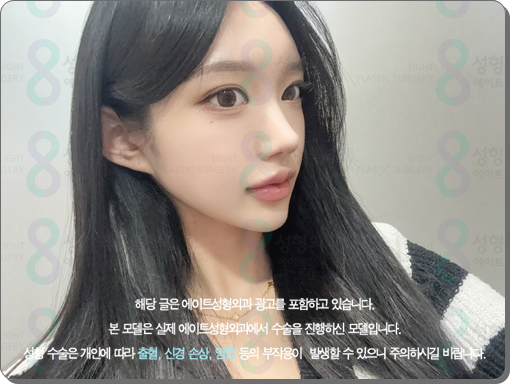 코수술 후기 일주일 1개월 비교? 평균 비용, 코성형 종류 장단점은? 관련 이미지 3