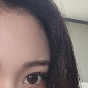 눈성형외과 내게 맞는 눈성형을 찾아요 관련 이미지 14