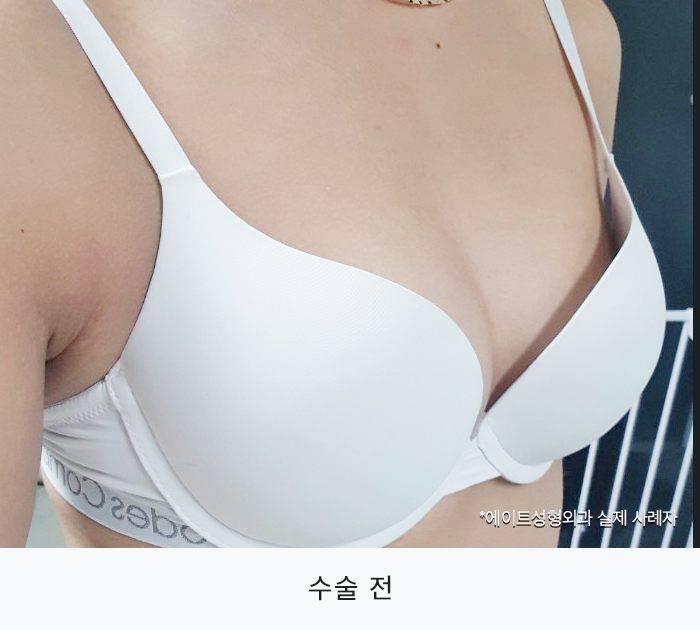 압구정가슴성형 원하는대로 자리할 수 있다면 관련 이미지 1