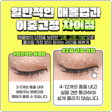 자연유착 매몰, 절개 차이 비교해봐요. 풀림 걱정없이 눈성형 비용과 후기 참고하는법 관련 이미지 11