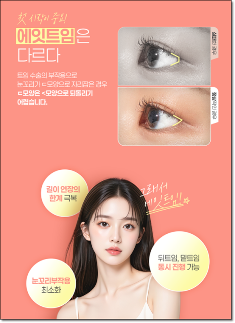 A Review of Upper Blepharoplasty Costs That Was Worth Every Penny! From How to Remove Mongolian Folds to Pricing and Recovery Care Tips image 15