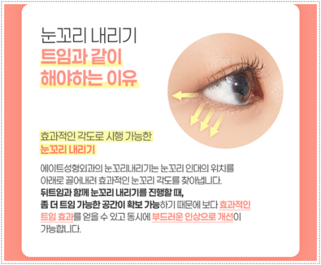 What Are the Prices and Combined Effects of Epicanthoplasty and Upper Epicanthoplasty with Double Eyelid Surgery? From Eye Shape Changes in Reviews of Front-and-Upper Epicanthoplasty to the Differences image 14