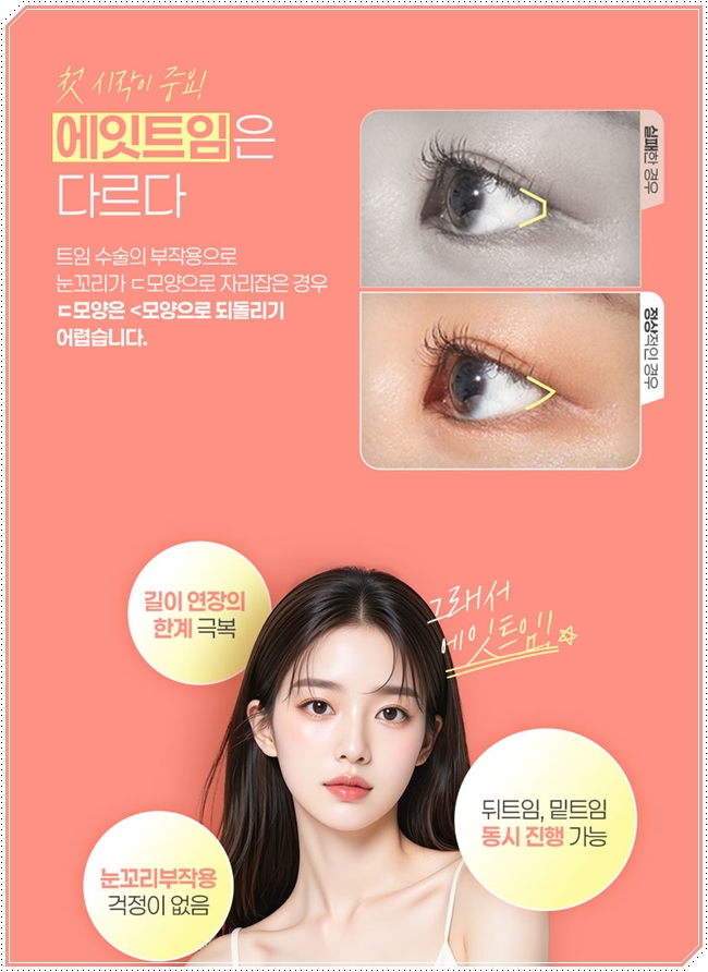 내 눈에 맞는 앞트임 필요할까? 수술 방법과 대략적인 비용 안내 관련 이미지 12
