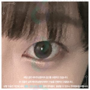 속쌍꺼풀 수술 티안나려면 인라인으로 해야할까? 관련 이미지 5