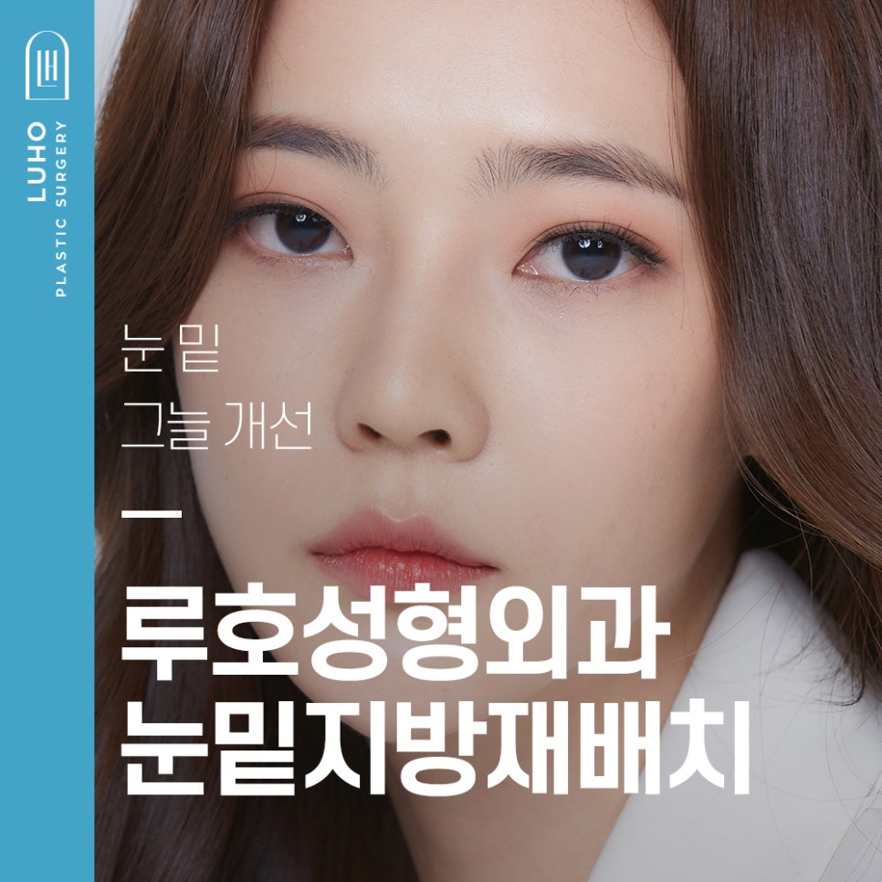 눈 밑 그늘 개선, 루호성형외과 눈밑지방재배치 관련 이미지 1