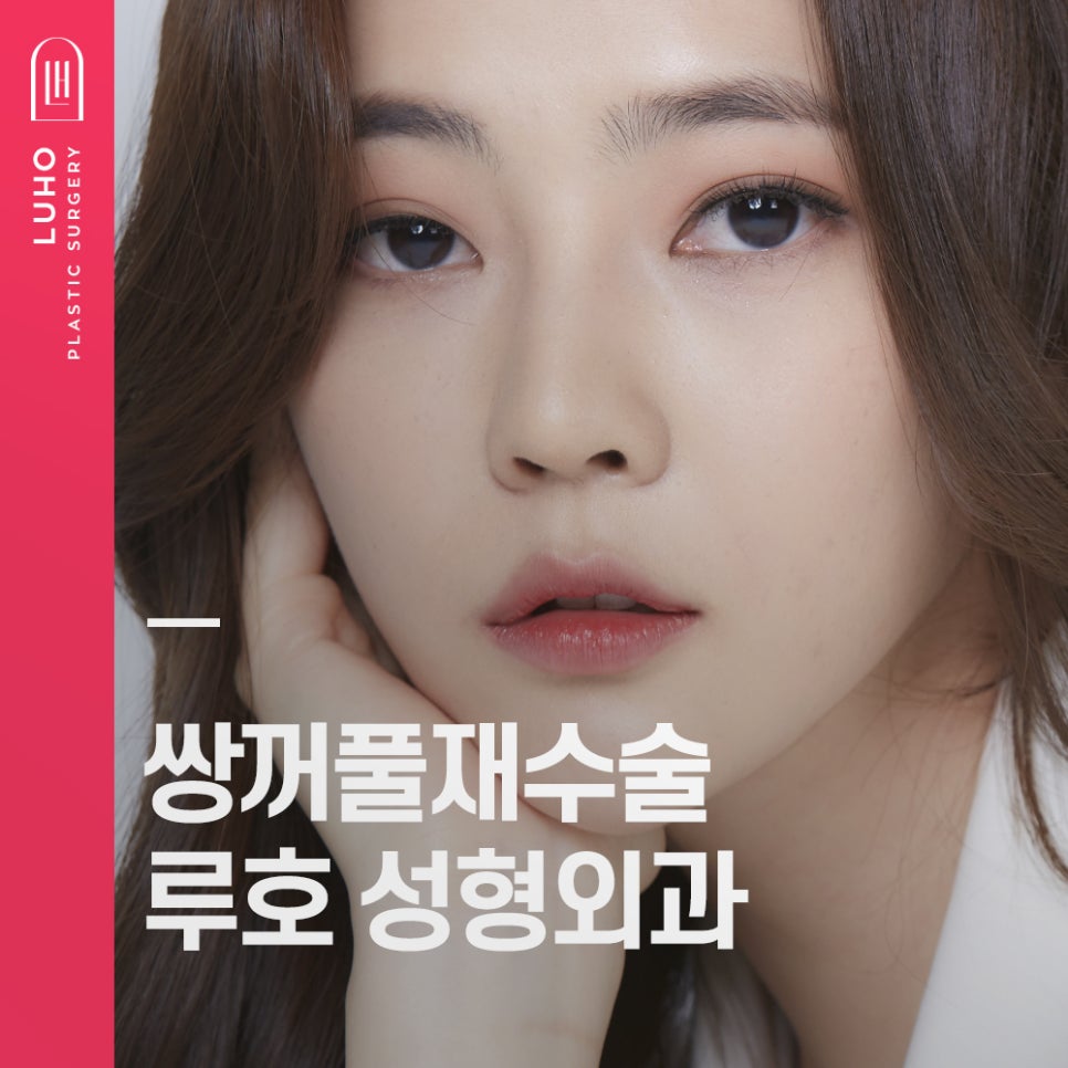 Double Eyelid Revision Surgery at Luho image 1