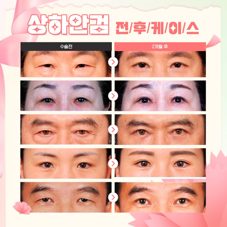 🌺루호성형외과 5월 가정의 달 효도 이벤트💐 관련 이미지 4