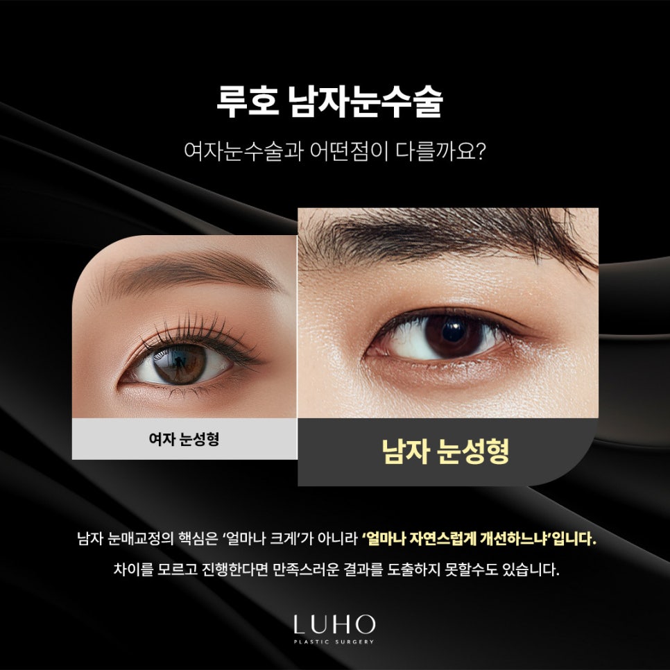A Place Near Sinsa Station Known for Eye Surgery, Key Points for Improving the Eye Shape image 4