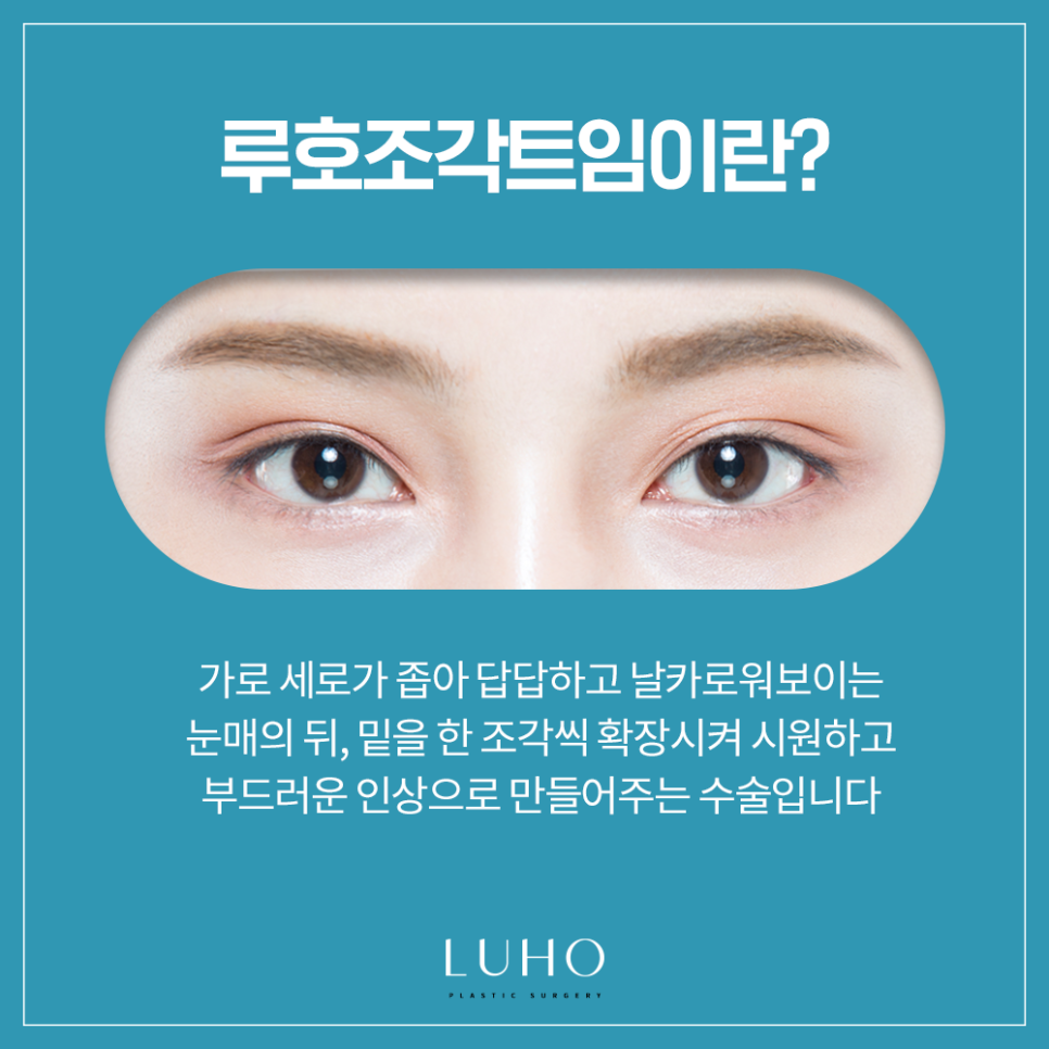 [루호성형외과] 작은 눈도 종류가 있다? 이런 분들은 꼭 트임 눈성형 하세요 관련 이미지 2