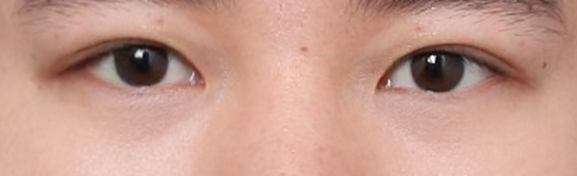 인아웃라인 쌍꺼풀, 나에게도 어울리게 만들려면 관련 이미지 5
