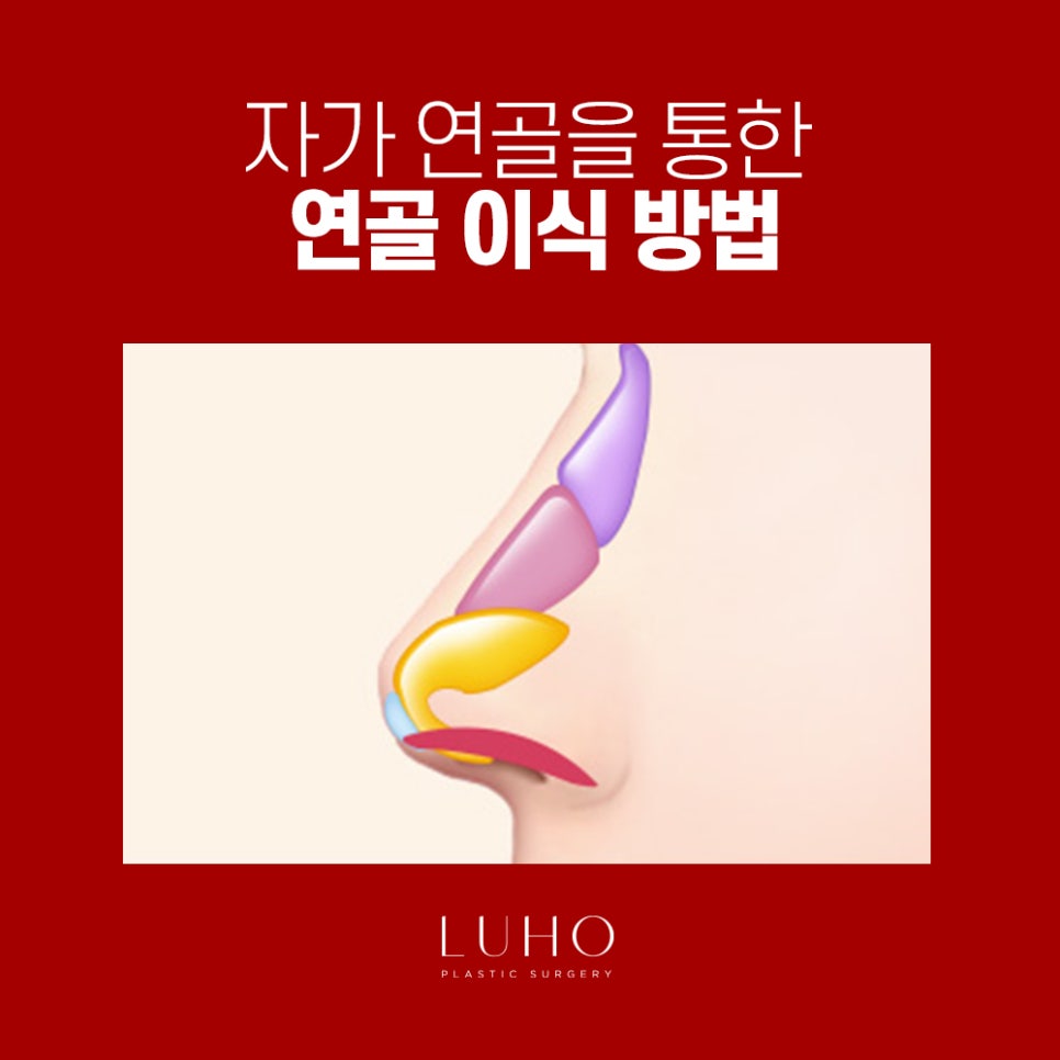 콧날개는 Down! 외모는 Up! 관련 이미지 6
