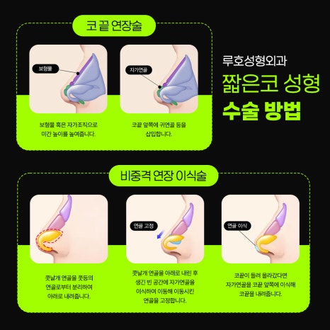 How to Address a Button Nose Based on a Surgery Review from Sinsa Station image 3
