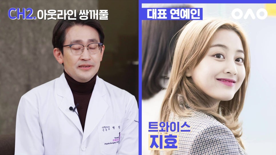 나에게 맞는 쌍커풀 라인은? - 아성원 관련 이미지 12