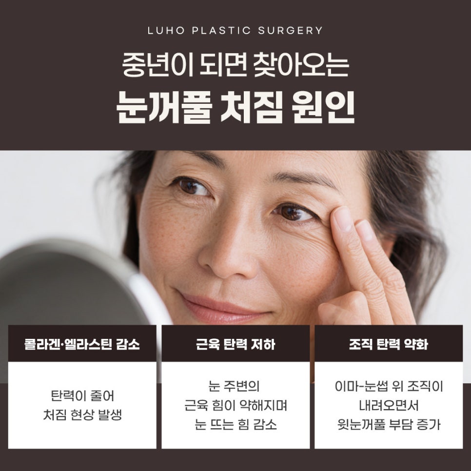 A Case of Correcting Midlife Eyelid Sagging with Upper Blepharoplasty at Sinsa Station image 2