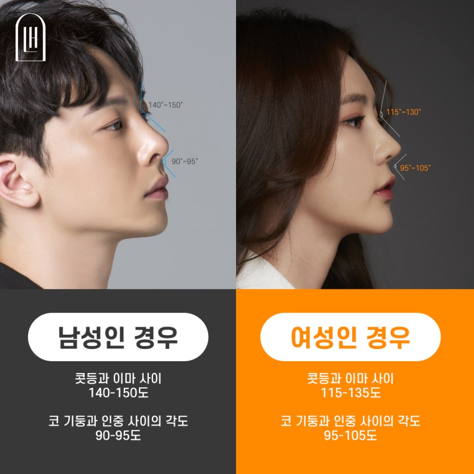 낮은 코 성형, 세련된 라인으로! 관련 이미지 2