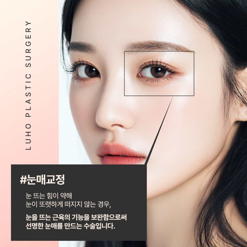첫인상을 바꾼 눈매 변화, 신사역 여자눈성형 사례 관련 이미지 3