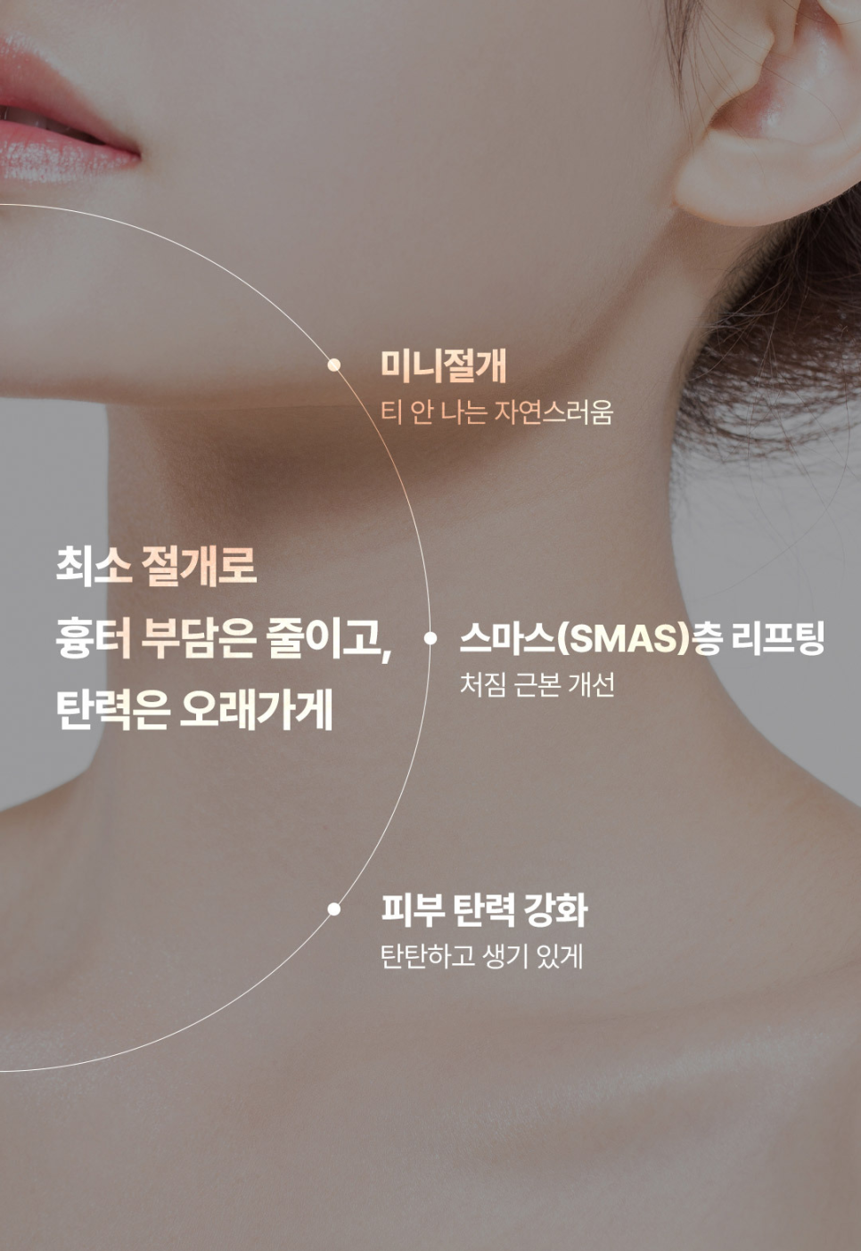 처진 얼굴선이 고민이었던 안면거상 사례 관련 이미지 4