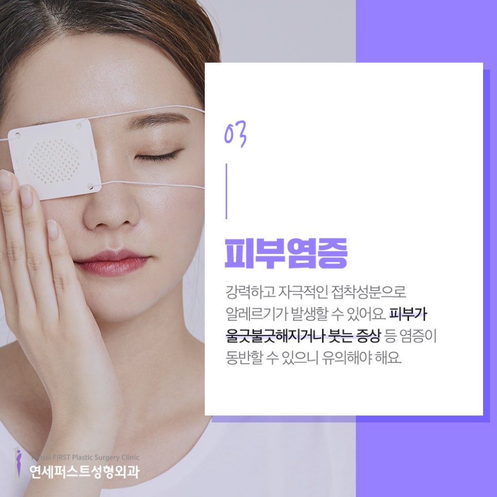 쌍꺼풀액, 쌍꺼풀테이프 사용하면 안되는 이유 (쌍액,쌍테 부작용) 관련 이미지 4