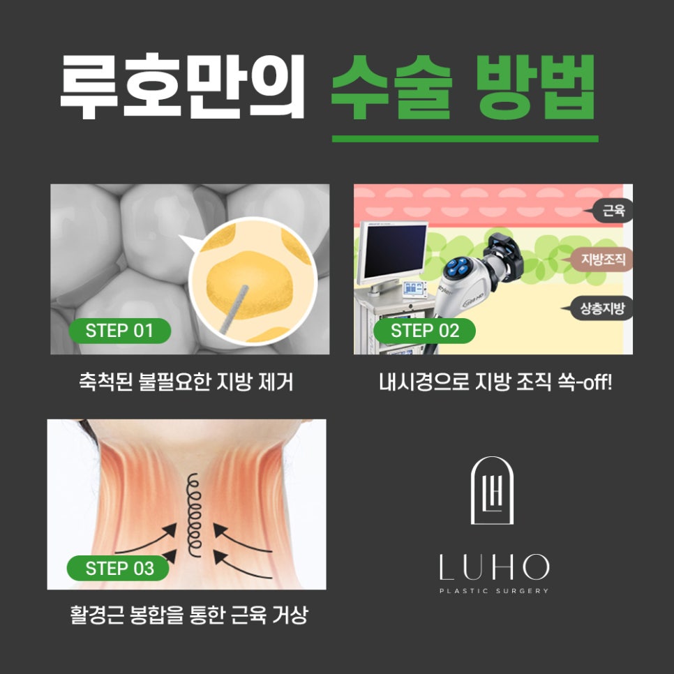 루호성형외과의 쏙 오프 지방흡입! 관련 이미지 6