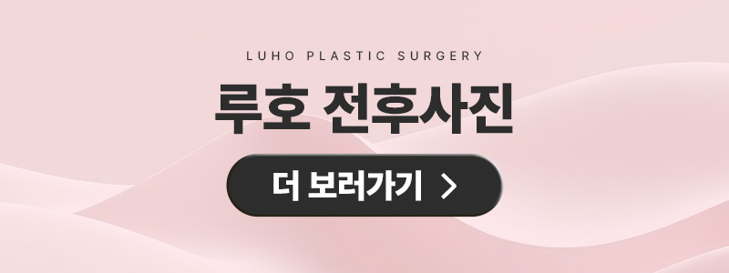 신사역 루호성형외과 눈재수술 라인 낮추기 관련 이미지 5