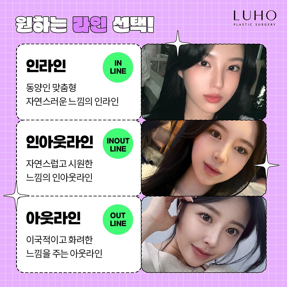 ［루호성형외과］ 맞춤형 눈성형 관련 이미지 2