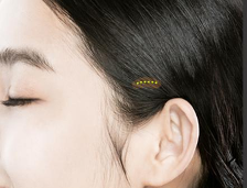 The Advantages of Lifting at a Glance: Ruho Plastic Surgery Mini Lifting image 8