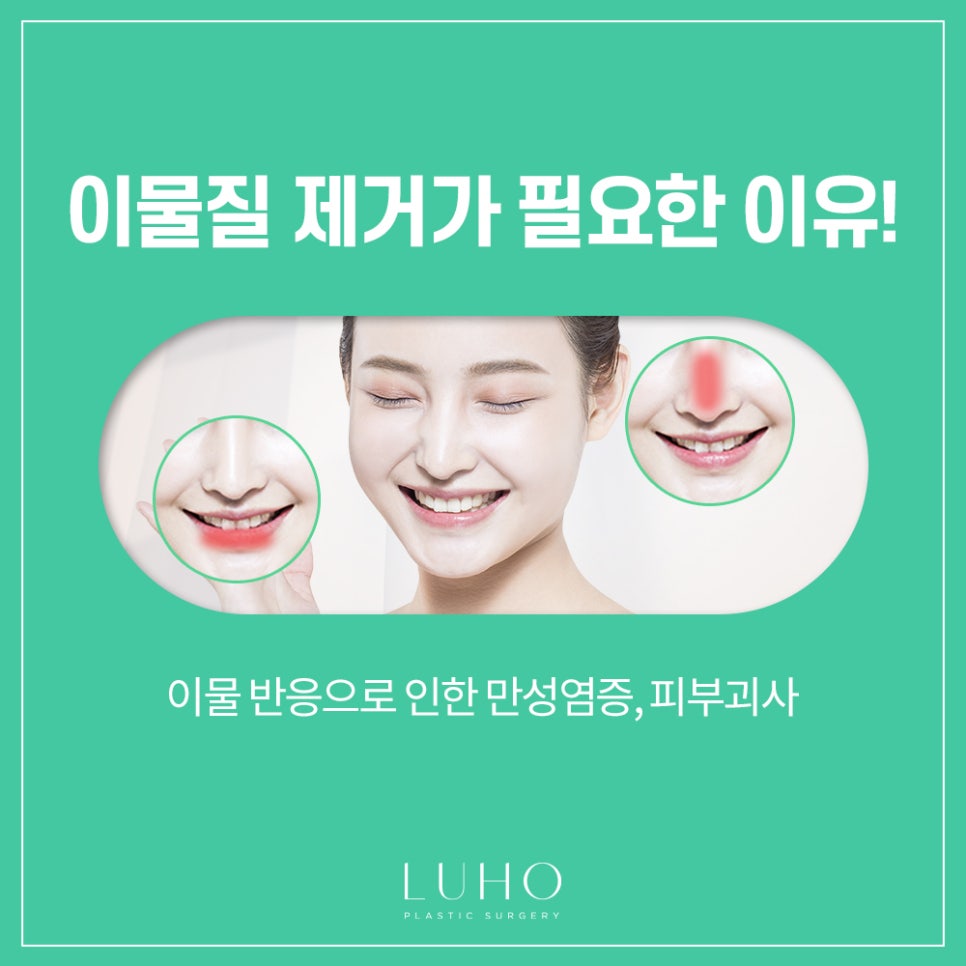 Luho Plastic Surgery Foreign Substance Removal image 3