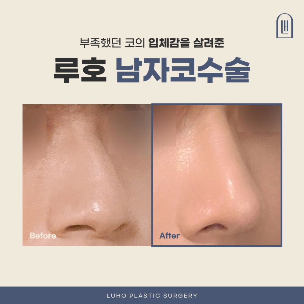 남자코수술, 조화로움을 만드는 원칙이 있습니다 관련 이미지 1