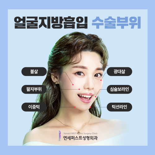 Looking for a way to lose facial fat? #FacialLiposuction image 5