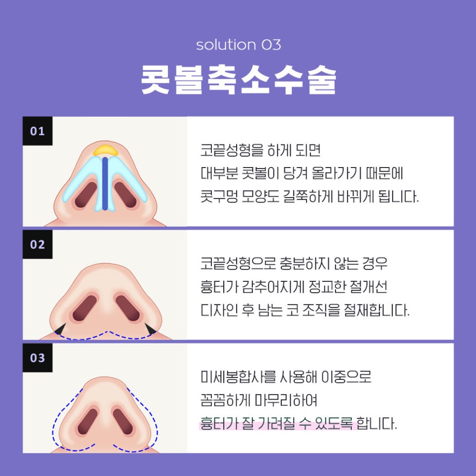 If You’re 고민 About Bulbous Nose Surgery, You Need to Know the Surgical Methods by Type image 6