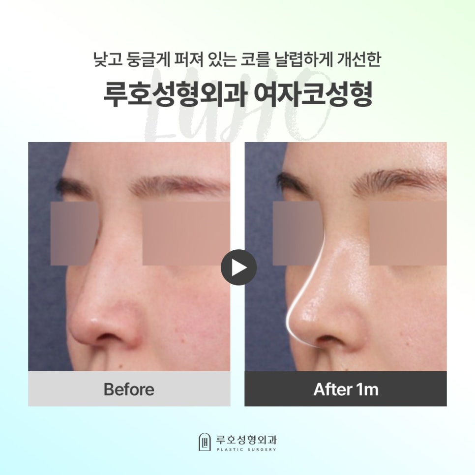 자려한 코라인으로 세련된 이미지를 완성한 여성코수술 관련 이미지 1