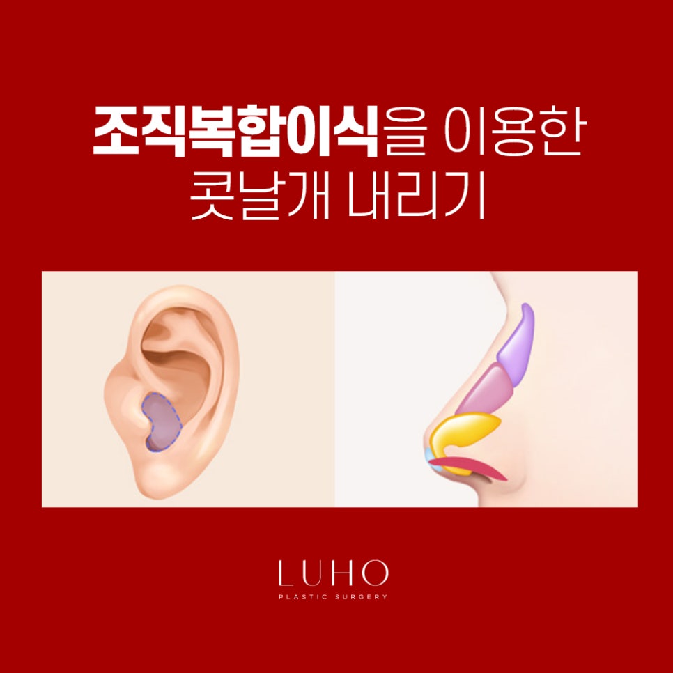 콧날개는 Down! 외모는 Up! 관련 이미지 8