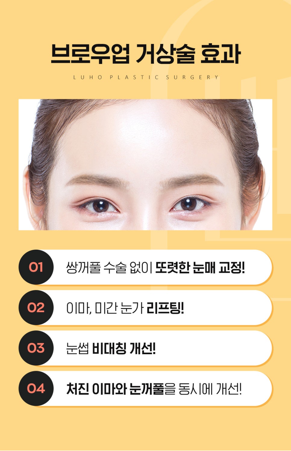 루호성형외과의 이마 거상술로 처진 눈과 리프팅효과까지! 관련 이미지 5