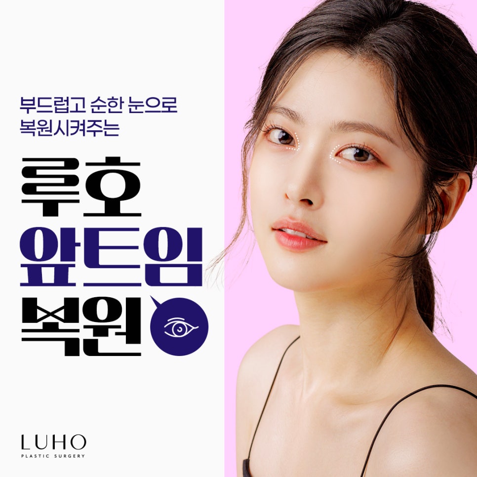 실패한 앞트임, 루호만의 노하우로 자연스럽게 복원 관련 이미지 1